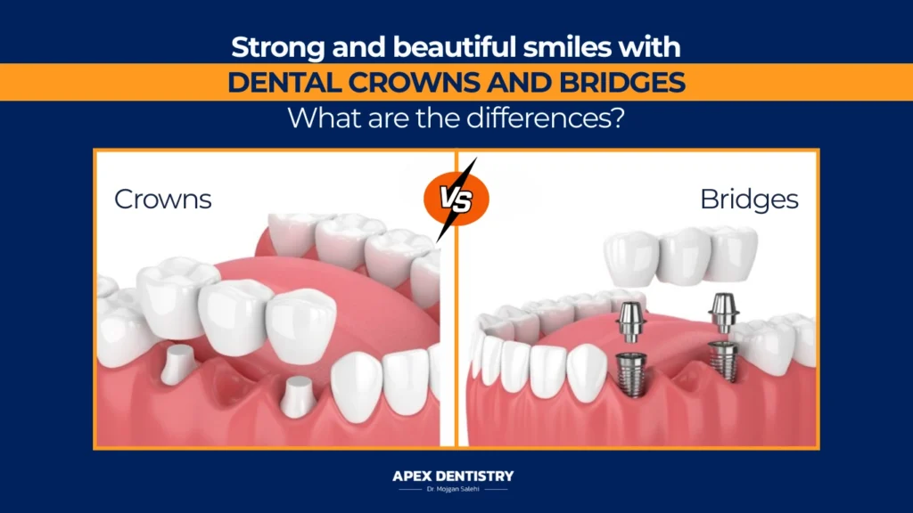 Dental Crowns and Bridges in Fort Pierce, FL