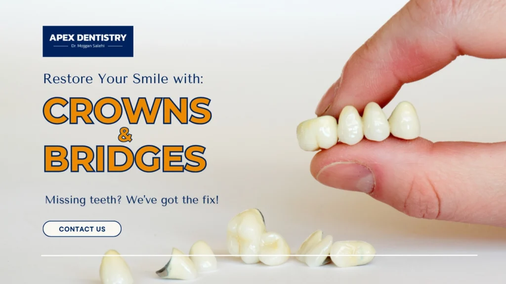 Apex Dentistry-Crowns & Bridges