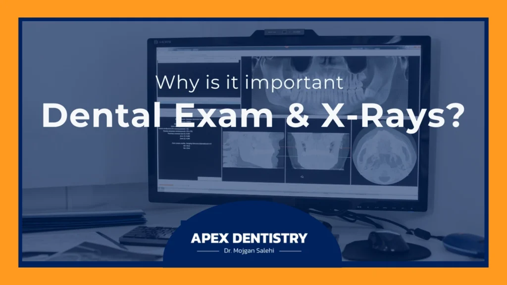 Apex dentistry-Dental